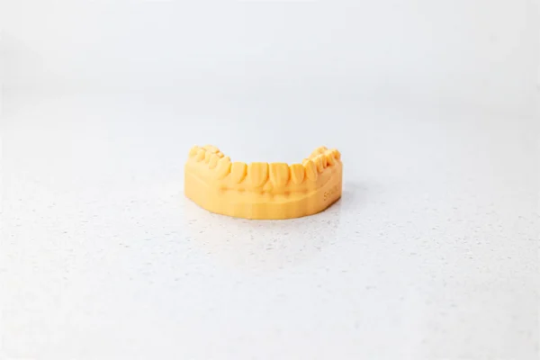 Vivid chrome yellow 3D resin dental model DM12 by Shining 3D, showcasing precision and clarity for dental professionals' diagnostic and treatment planning needs